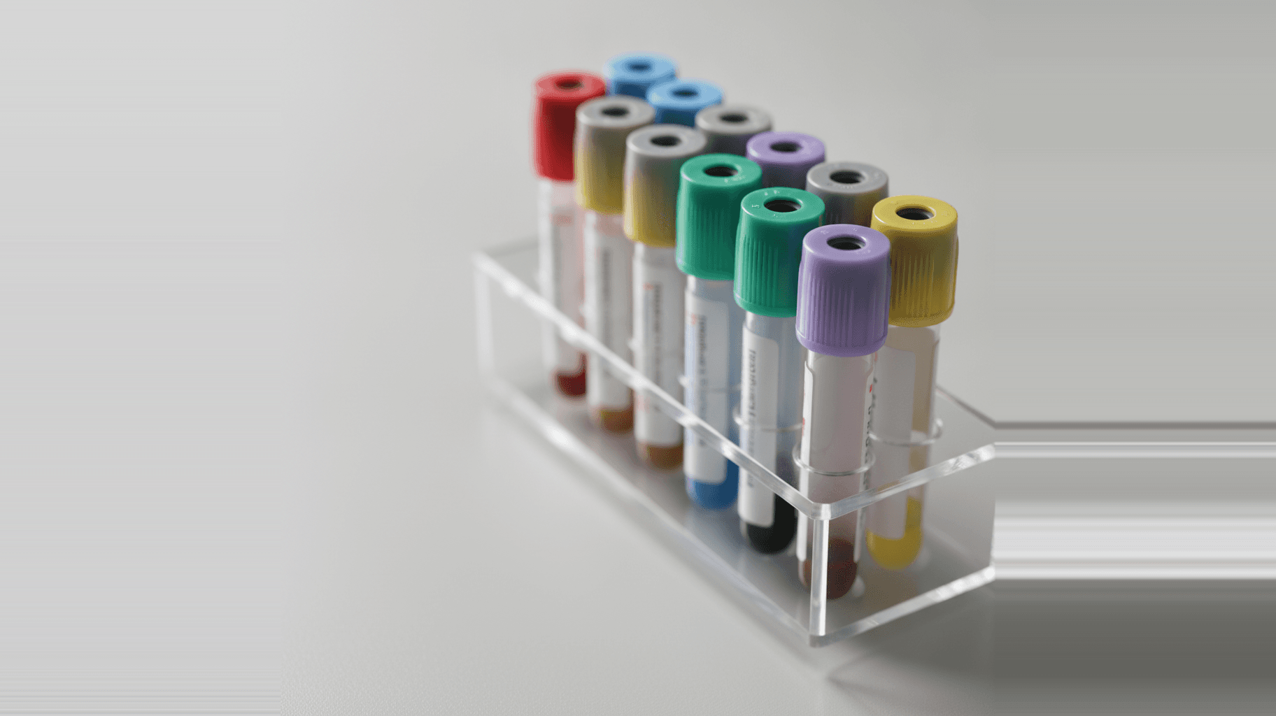 A rack of color-coded blood collection tubes — red, light blue, green, gray, lavender, and yellow caps — the standardized Vacutainer-style additive system used across clinical specimen collection