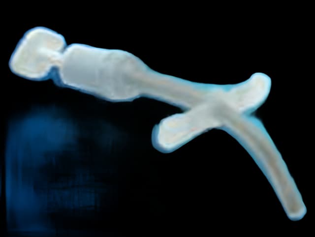 Uncuffed Tracheostomy Tube Bivona® FlexTend™ Plus Size 4.0 Pediatric - 60PFPS40