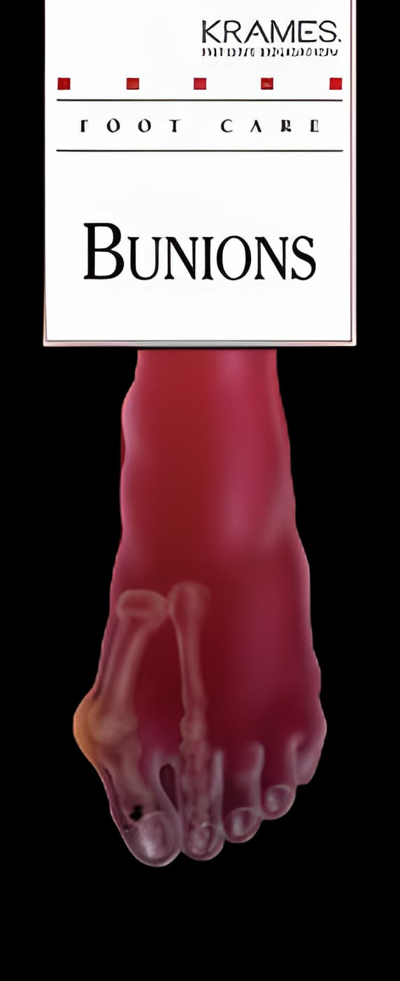 Krames Podiatry Bunions Brochure - Patient Education