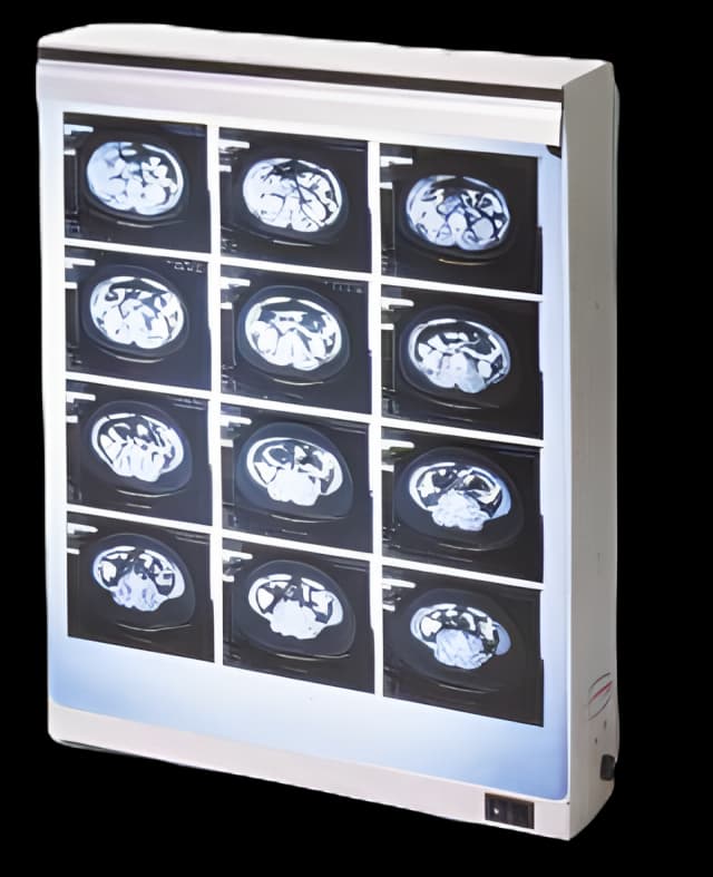 X-Ray Illuminator Econoline 2 Bank 1 Tier 2 Lamp 15 W Wall Mount 3-1/2 X 18-1/4 X 28 Inch White Two, 14 X 17 Inch Film