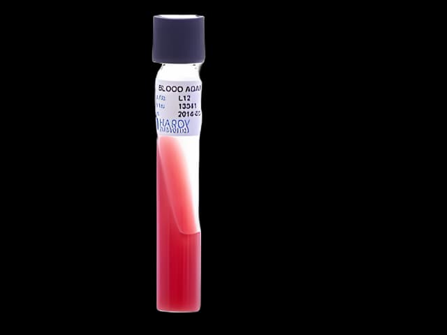 Prepared Media Tryptic Soy Agar (TSA) with 5% Sheep Blood Slant Tube Format