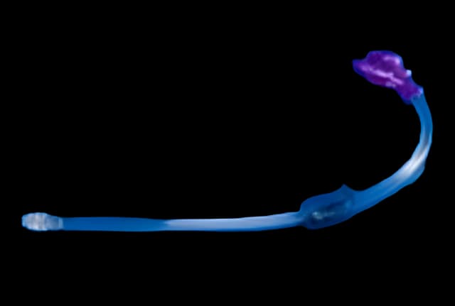 Skin Level Tube Access Continuous Right Angle Feeding Set Kangaroo™ NonSterile