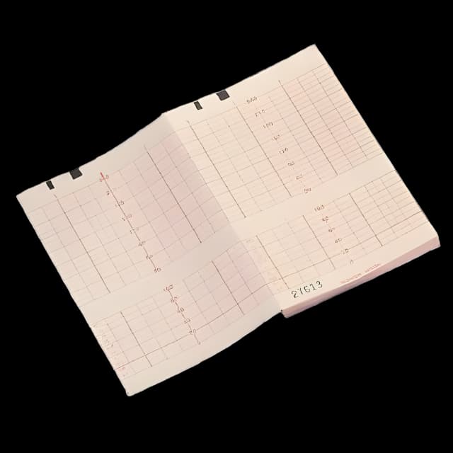 Fetal Monitor Recording Paper Philips Thermal Paper 150 mm X 49 Foot Z-Fold Green Grid