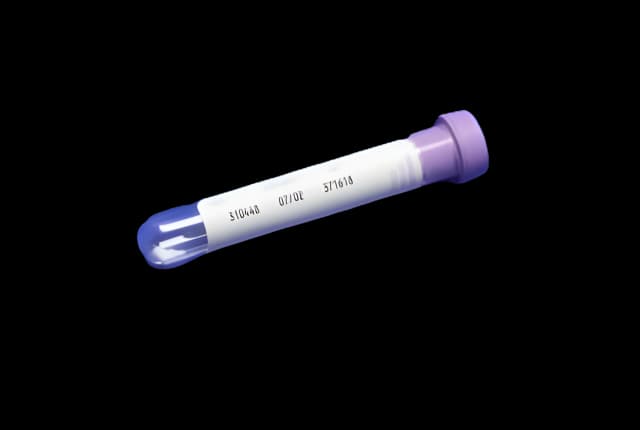Monoject K3 EDTA 2mL Blood Collection Tube - 8881311149
