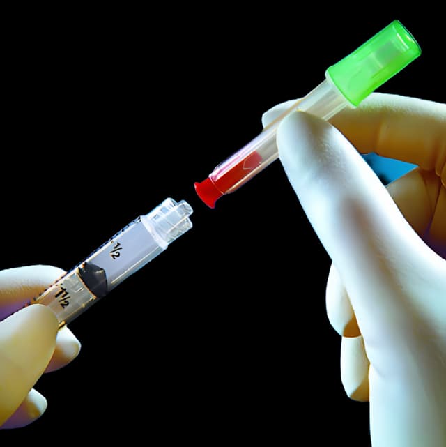 Dual Cannula with Syringe TwinPak™ Vial Access Pin / Blunt Tip Cannula 3 mL 20 Gauge Pin / 17 Gauge Cannula