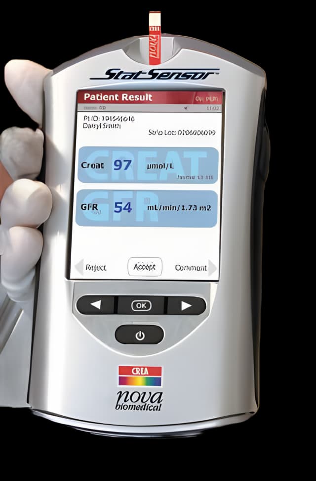 StatSensor Creatinine Meter Strips for Quick Renal Testing