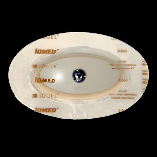 Iontophoresis Electrode Kit IOGEL® 3.5 mL Fill Volume 12/Pk