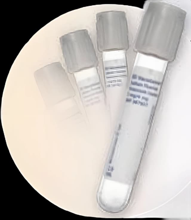 BD Vacutainer® Venous Blood Collection Tube Sodium Fluoride / Potassium Oxalate Additive 10 mL Conventional Closure Glass Tube