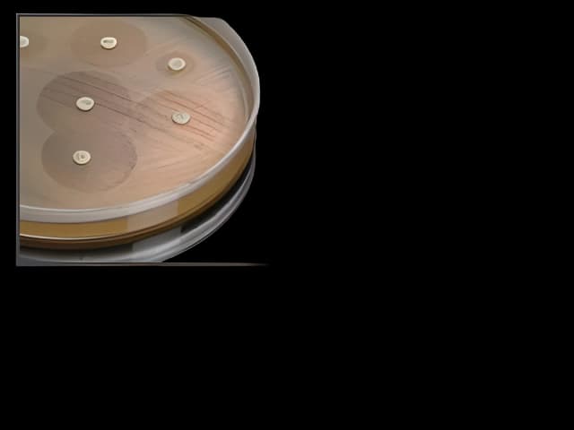 Haemophilus Agar Plates for Lab Testing - Hardy Diagnostics