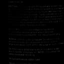 McKesson Mist Anesthetic Spray 115mL - Quick Pain Relief