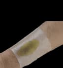 Hydrocolloid Dressing Excel 2 X 2 Inch Square