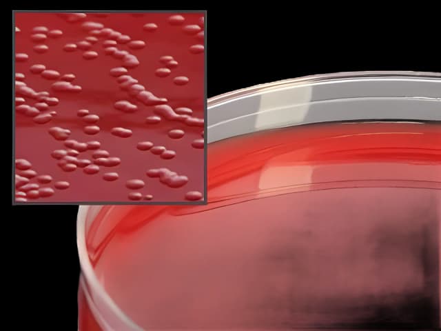 Prepared Media Cefoperazone, Vancomycin, Amphotericin B (Campy CVA) Agar with 5% Sheep Blood Petri Plate Format