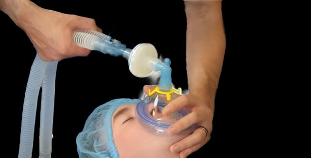 Flexicare® Anesthesia Breathing Circuit Corrugated Tube 60 Inch Tube Dual Limb Adult 3 Liter Bag Single Patient Use - 038-01-601U