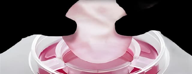 Skin Graft Therapy Apligraf® Round Viable human cells, cultured in vitro