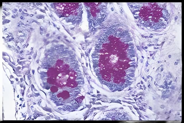 Periodic Acid Schiff (PAS) Stain Kit Richard-Allan Scientific™ 3 X 500 mL