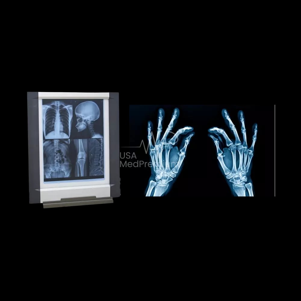 X-Ray