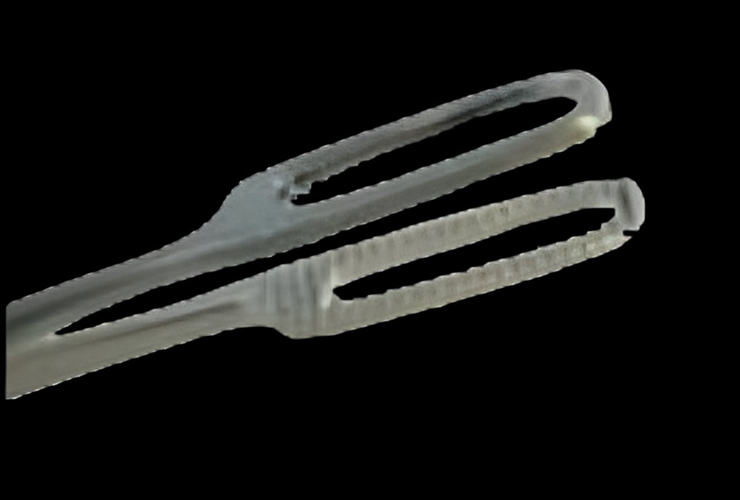 Obstetrical Forceps MedGyn Sopher Original 10-1/2 Inch Length Surgical Grade Stainless Steel NonSterile NonLocking Finger Ring Handle Slightly Curved Medium Serrated Oval Jaws with Concave Tips