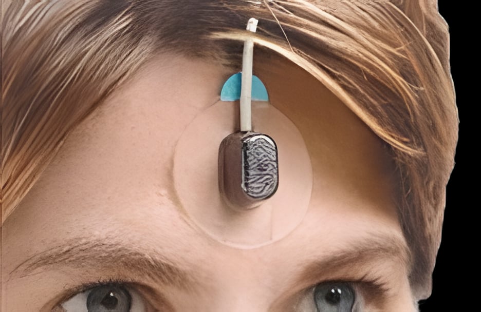SpO2 Sensor PureLight® Forehead Adult Reusable