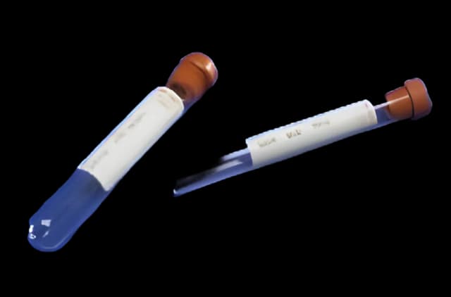 Monoject™ Venous Blood Collection Tube Plain 7 mL Conventional Closure Glass Tube - 8881301611