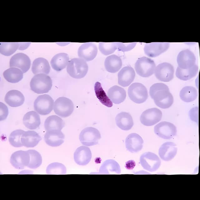 Naegleria Fowleri Stained Slide Set - Pre-Stained, 5-Pack